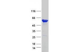 Validation with Western Blot