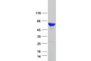 Validation with Western Blot (CES1 Protein (Transcript Variant 2) (Myc-DYKDDDDK Tag))