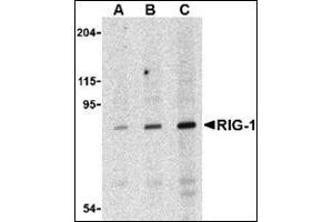 Western blot analysis of RIG-1 in C2C12 cell lysate with this product at (A) 0. (DDX58 anticorps)