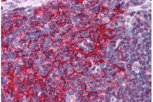 Human Thymus: Formalin-Fixed, Paraffin-Embedded (FFPE) (EFHD2 anticorps  (N-Term))