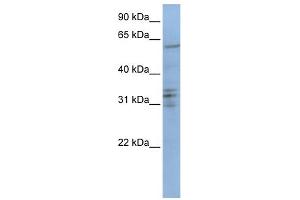 WB Suggested Anti-CENPB Antibody Titration: 0. (CENPB anticorps  (C-Term))