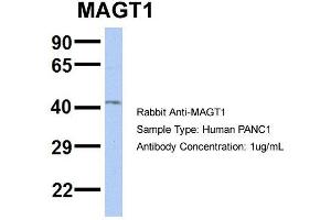 Host: Rabbit Target Name: MAGT1 Sample Type: PANC1 Antibody Dilution: 1. (MAGT1 anticorps  (N-Term))