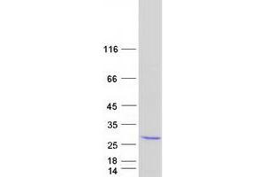 Validation with Western Blot