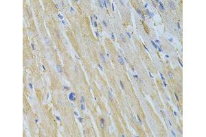 Immunohistochemistry of paraffin-embedded Rat heart using NME1 Polyclonal Antibody at dilution of 1:200 (40x lens). (NME1 anticorps)