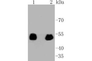 Lane 1: 293 lysates, Lane 2: F9 lysates probed with p53(S392) (3A1) Monoclonal Antibody  at 1:1000 overnight at 4˚C. (p53 anticorps  (pSer392))