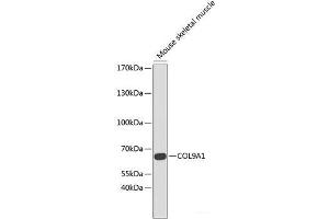 Western blot analysis of extracts of Mouse skeletal muscle using COL9A1 Polyclonal Antibody at dilution of 1:1000. (COL9A1 anticorps)