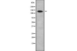 Western blot analysis of ADAMTS2 using COLO205 whole cell lysates