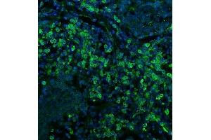 IF analysis of CD74 using anti-CD74 antibody (ABIN7603166). (CD74 anticorps  (N-Term))