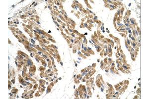 SLC35F2 antibody was used for immunohistochemistry at a concentration of 4-8 ug/ml. (SLC35F2 anticorps  (N-Term))
