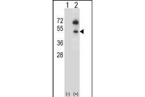 Western blot analysis of GNAS (arrow) using rabbit polyclonal GNAS Antibody (C-term) (ABIN656989 and ABIN2850497). (GNAS anticorps  (C-Term))