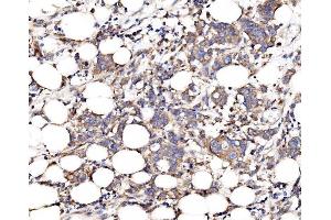 IHC analysis of FKBP135/FKBP15 using anti-FKBP135/FKBP15 antibody (ABIN7600397).