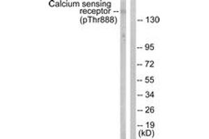 Western blot analysis of extracts from LOVO cells, using Calcium Sensing Receptor (Phospho-Thr888) Antibody. (CASR anticorps  (pThr888))