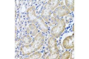 Immunohistochemistry of paraffin-embedded mouse kidney using HD antibody (ABIN3022456, ABIN3022457, ABIN3022458 and ABIN6218830) at dilution of 1:100 (40x lens).