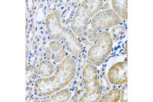 Immunohistochemistry of paraffin-embedded mouse kidney using HD antibody (ABIN3022456, ABIN3022457, ABIN3022458 and ABIN6218830) at dilution of 1:100 (40x lens). (HDAC6 anticorps  (AA 1-200))