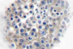 Immunohistochemistry (IHC) analyzes of AR alpha2A antibody in paraffin-embedded human testis tissue. (ADRA2A anticorps)