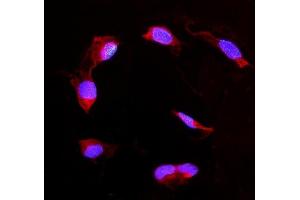 IF analysis of DDAH2 using anti-DDAH2 antibody (ABIN4886561). (DDAH2 anticorps  (C-Term))