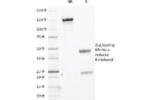 SDS-PAGE Analysis Purified Cytokeratin, HMW MAb (KRTH/1076).