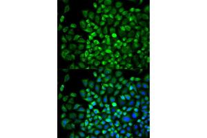 Immunofluorescence analysis of A549 cell using ANGPTL4 antibody. (ANGPTL4 anticorps  (AA 26-406))