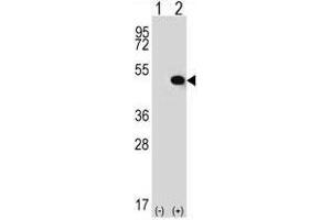Western blot analysis of TRIP13 (arrow) using rabbit polyclonal TRIP13 Antibody (C-term) . (TRIP13 anticorps  (C-Term))