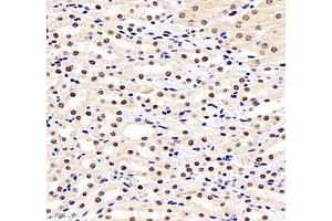 Immunohistochemistry of paraffin embedded mouse kidney using GTF3C3 (ABIN7074039) at dilution of 1: 2500 (400x lens)