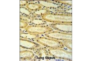 HSD17B11 Antibody (N-term) (ABIN653756 and ABIN2843056) IHC analysis in formalin fixed and paraffin embedded lung tissue followed by peroxidase conjugation of the secondary antibody and DAB staining.