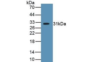 Detection of Recombinant MYH2, Human using Polyclonal Antibody to Myosin Heavy Chain 2 (MYH2)
