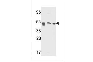 Western blot analysis in Y79,A2058,CEM cell line lysates(35ug/lane) (APCS anticorps  (AA 285-314))