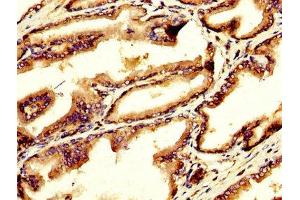 IHC image of ABIN7154533 diluted at 1:200 and staining in paraffin-embedded human prostate tissue performed on a Leica BondTM system.