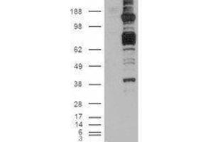 Western Blotting (WB) image for Caspase Recruitment Domain Family, Member 11 (CARD11) peptide (ABIN369694)