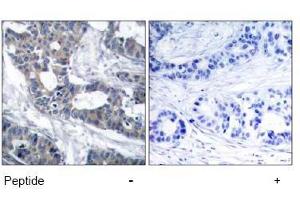 Image no. 1 for anti-Mitogen-Activated Protein Kinase Kinase 1 (MAP2K1) (Thr291) antibody (ABIN197562)
