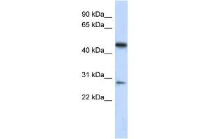 WB Suggested Anti-C13orf31 Antibody Titration: 0. (LACC1 anticorps  (Middle Region))