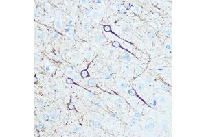 Immunohistochemistry of paraffin-embedded rat brain using Neurofilament M Rabbit pAb (ABIN7268865) at dilution of 1:100 (40x lens).