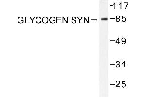 Image no. 1 for anti-Glycogen Synthase (GYS) antibody (ABIN265444) (Glycogen Synthase anticorps)