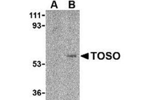 Western blot analysis of Toso in human lung tissue lysate with this product at 1 μg/ml in either the (A) presence, or (B) absence of blocking peptide. (FAIM3 anticorps  (C-Term))