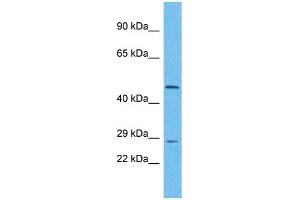 Host: Rabbit Target Name: UTP11L Sample Type: Hela Whole Cell lysates Antibody Dilution: 1. (UTP11L anticorps  (N-Term))