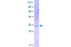 Image no. 1 for Defensin beta 4 (DEFB4) (AA 1-64) protein (GST tag) (ABIN1351428)