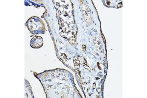 Immunohistochemistry of paraffin-embedded human placenta using CHRN Rabbit pAb (ABIN6133256, ABIN6138583, ABIN6138584 and ABIN6218660) at dilution of 1:100 (40x lens). (CHRNA7 anticorps  (AA 23-230))