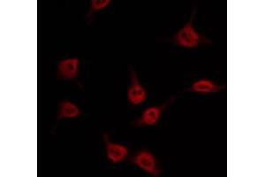 ABIN6274557 staining Hela by IF/ICC.