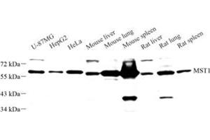 Western blot analysis of MST1 (ABIN7075561) at dilution of 1: 1000 (STK4 anticorps)