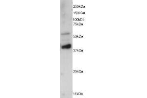 Image no. 1 for anti-Protein Phosphatase 2, Regulatory Subunit B', epsilon Isoform (PPP2R5E) (C-Term) antibody (ABIN374131) (PPP2R5E anticorps  (C-Term))