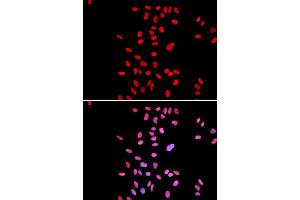 Immunofluorescence analysis of U2OS cells using DKC1 antibody (ABIN5970956). (DKC1 anticorps)