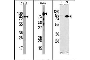 Image no. 1 for anti-Phosphoinositide 3 Kinase, p85 alpha (PI3K p85a) (N-Term) antibody (ABIN360455)