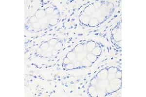 Immunohistochemistry of paraffin-embedded Human colon (negative control sample) using [KO Validated] p53 Rabbit mAb (ABIN7271080) at dilution of 1:100 (40x lens).