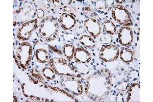 Immunohistochemical staining of paraffin-embedded Kidney tissue using anti-BTK mouse monoclonal antibody. (BTK anticorps)