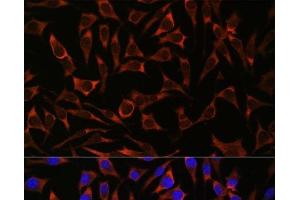 Immunofluorescence analysis of L929 cells using SEPT8 Polyclonal Antibody at dilution of 1:100.