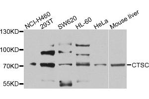 Western blot analysis of extracts of various cell lines, using CTSC antibody (ABIN5974676) at 1/1000 dilution. (CTSC anticorps)