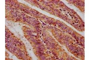 anti-Chromosome X Open Reading Frame 36 (CXORF36) (AA 311-405) antibody