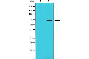 Western blot analysis on HuvEc cell lysate using Cox1 Antibody,The lane on the left is treated with the antigen-specific peptide.