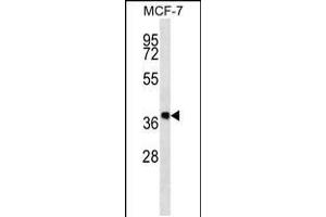 Western blot analysis in MCF-7 cell line lysates (35ug/lane). (DHRS7B anticorps  (AA 133-161))