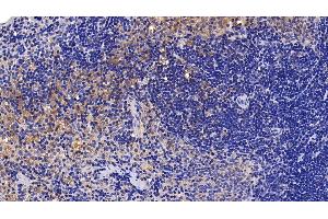 Detection of IL1RAP in Rat Spleen Tissue using Polyclonal Antibody to Interleukin 1 Receptor Accessory Protein (IL1RAP)